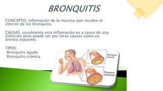 Presentación Bronquitis MDFC LETT.pptx