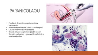 PAPANICOLAOU
• Prueba de detección para diagnóstico y
tratamiento
• Muestras epiteliales del cérvix y canal vaginal
• Células observadas al microscopio
• Detecta células neoplásicas (posible cáncer)
• También exploración y observación del cérvix y
paredes aledañas
 
