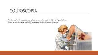 COLPOSCOPIA
• Prueba realizada tras observar células anormales en la tinción de Papanicolaou
• Observación del canal vaginal y cérvix por medio de un microscopio
 