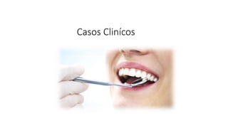 Casos Clinícos
 
