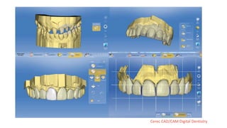 Cerec CAD/CAM Digital Dentistry
 