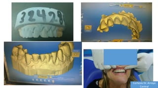 Cortesía Dr. Arroyo
Central
 