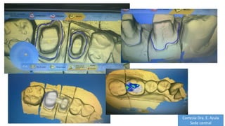 Cortesía Dra. E. Azula
Sede central
 