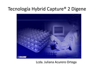 Tecnología Hybrid Capture® 2 Digene Lcda. Juliana Acurero Ortega 