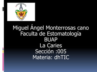 Miguel Ángel Monterrosas cano
Faculta de Estomatología
BUAP
La Caries
Sección :005
Materia: dhTIC

 