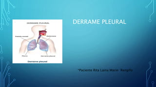 DERRAME PLEURAL
•
*Paciente Rita Laina Marin Rengifo
 