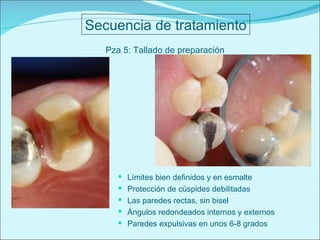 Secuencia de tratamiento Pza 5: Tallado de preparación Límites bien definidos y en esmalte  Protección de cúspides debilitadas Las paredes rectas, sin bisel Ángulos redondeados internos y externos Paredes expulsivas en unos 6-8 grados 