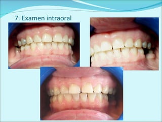 7. Examen intraoral 