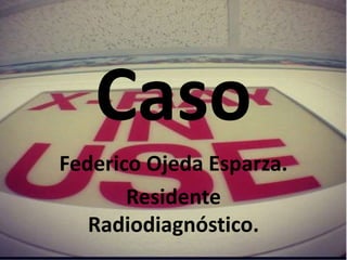 Caso
Federico Ojeda Esparza.
Residente
Radiodiagnóstico.
 