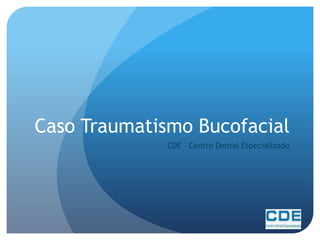Caso Traumatismo Bucofacial
CDE – Centro Dental Especializado
 