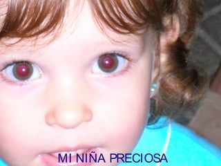 MI NIÑA PRECIOSA
 