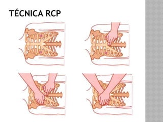 Rcp RCP CURSO BASICOS PARA PRIMEROS AUXILIOS | PPTX