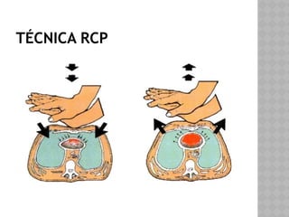 RCP CURSO BASICOS PARA PRIMEROS AUXILIOS | PPTX