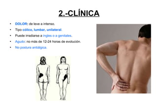 2.-CLÍNICA
 DOLOR: de leve a intenso.
 Tipo cólico, lumbar, unilateral.
 Puede irradiarse a ingles o a genitales.
 Agudo: no más de 12-24 horas de evolución.
 No postura antiálgica.
 