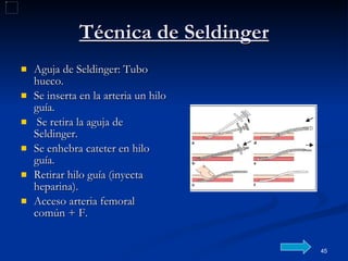 Técnica de Seldinger Aguja de Seldinger: Tubo hueco. Se inserta en la arteria un hilo guía. Se retira la aguja de Seldinger. Se enhebra cateter en hilo guía. Retirar hilo guía (inyecta heparina). Acceso arteria femoral común + F. 