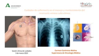 Carmen Contreras Molina
Supervisora de Oncología Médica
Cuidados de enfermería en el manejo y mantenimiento del
reservorio venoso subcutáneo
Sesión clínica de cuidados
3 de marzo 2022
 