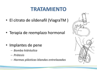 TRATAMIENTO
• El citrato de sildenafil (ViagraTM )
• Terapia de reemplazo hormonal
• Implantes de pene
– Bomba hidráulica
– Prótesis
– Hormas plásticas blandas entrelazadas