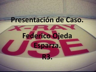 Presentación de Caso.
Federico Ojeda
Esparza.
R3.
 