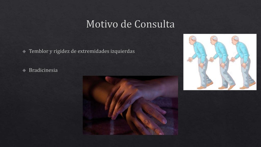 Presentación de caso clínico y Parkinson Presentación de caso clínico y Parkinson