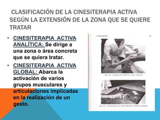 CLASIFICACIÓN DE LA CINESITERAPIA ACTIVA
SEGÚN LA EXTENSIÓN DE LA ZONA QUE SE QUIERE
TRATAR
• CINESITERAPIA ACTIVA
ANALÍTICA: Se dirige a
una zona o área concreta
que se quiera tratar.
• CINESITERAPIA ACTIVA
GLOBAL: Abarca la
activación de varios
grupos musculares y
articulaciones implicadas
en la realización de un
gesto.
 