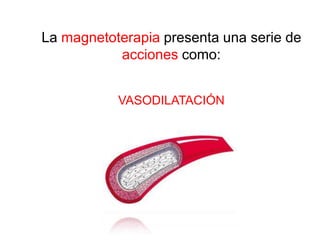 La magnetoterapia presenta una serie de
           acciones como:


           VASODILATACIÓN
 