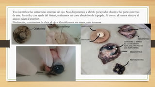Tras identificar las estructuras externas del ojo. Nos disponemos a abrirlo para poder observar las partes internas
de este. Para ello, con ayuda del bisturí, realizamos un corte alrededor de la pupila. Al cortar, el humor vítreo y el
acuoso salen al exterior.
Finalmente, terminamos de abrir el ojo e identificamos sus estructuras internas.