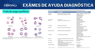 EXÁMES DE AYUDA DIAGNÓSTICA
Frotis de sangre periférica
 