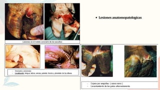 Lesiones anatomopatologícas
 