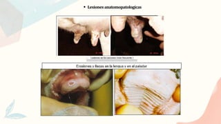 Lesiones anatomopatologícas
 