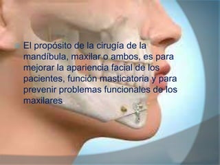 

El propósito de la cirugía de la
mandíbula, maxilar o ambos, es para
mejorar la apariencia facial de los
pacientes, función masticatoria y para
prevenir problemas funcionales de los
maxilares.

 