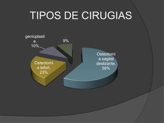 TIPOS DE CIRUGIAS
genioplasti
a.
10%

Osteotomi
a lefort.
23%

.
9%

Osteotomi
a sagital
deslizante.
58%

 