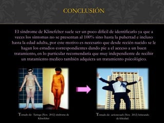 CONCLUSIÓN


 El síndrome de Klinefelter suele ser un poco difícil de identificarlo ya que a
 veces los síntomas no se presentan al 100% sino hasta la pubertad e incluso
hasta la edad adulta, por este motivo es necesario que desde recién nacido se le
     hagan los estudios correspondientes dando pie a el acceso a un buen
 tratamiento, en lo particular recomendaría que muy independiente de recibir
     un tratamiento medico también adquiera un tratamiento psicológico.




   Tomado de:   Taringa (Nov. 2012) síndrome de   Tomado de:   actioncoach (Nov. 2012) brincando
                    Klinefelter                                     de felicidad.
 