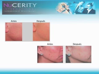 Trabajas por dineroA: AutoempleadoAlto riesgo