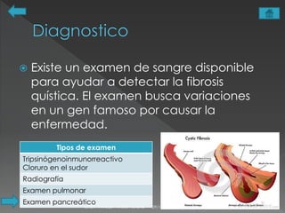  Existe un examen de sangre disponible 
para ayudar a detectar la fibrosis 
quística. El examen busca variaciones 
en un gen famoso por causar la 
enfermedad. 
Tipos de examen 
Tripsinógenoinmunorreactivo 
Cloruro en el sudor 
Radiografía 
Examen pulmonar 
Examen pancreático 
LINDA VANESSA PINZÓN CASAS 29/10/2014 7 
 