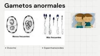 Gametos anormales
Gametos anormales
Ovocito Espermatozoides
 
