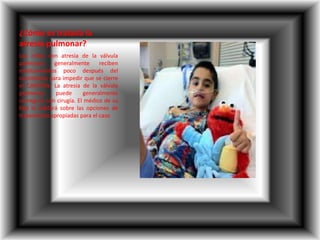 ¿Cómo es tratada la
atresia pulmonar?
Los niños con atresia de la válvula
pulmonar, generalmente reciben
medicamentos poco después del
nacimiento para impedir que se cierre
el CAP/PDA. La atresia de la válvula
pulmonar, puede generalmente
corregirse con cirugía. El médico de su
hijo le hablará sobre las opciones de
tratamiento apropiadas para el caso
 
