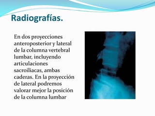 Radiografías.
En dos proyecciones
anteroposterior y lateral
de la columna vertebral
lumbar, incluyendo
articulaciones
sacroiliacas, ambas
caderas. En la proyección
de lateral podremos
valorar mejor la posición
de la columna lumbar

 