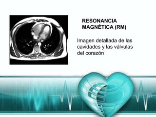 RESONANCIA
  MAGNÉTICA (RM)

Imagen detallada de las
cavidades y las válvulas
del corazón
 