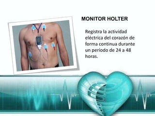 MONITOR HOLTER

 Registra la actividad
 eléctrica del corazón de
 forma continua durante
 un período de 24 a 48
 horas.
 