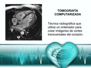 TOMOGRAFÍA
    COMPUTARIZADA


Técnica radiográfica que
utiliza un ordenador para
crear imágenes de cortes
transversales del corazón.
 