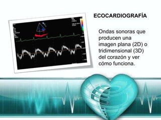 ECOCARDIOGRAFÍA

 Ondas sonoras que
 producen una
 imagen plana (2D) o
 tridimensional (3D)
 del corazón y ver
 cómo funciona.
 