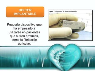 HOLTER
    IMPLANTABLE


Pequeño dispositivo que
      ha empezado a
 utilizarse en pacientes
  que sufren arritmias,
    como la fibrilación
         auricular.
 