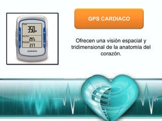 GPS CARDIACO



   Ofrecen una visión espacial y
tridimensional de la anatomía del
            corazón.
 