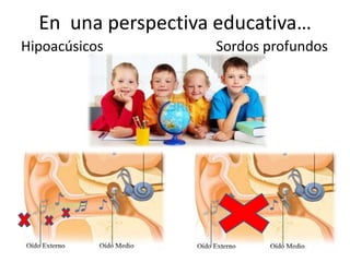 En una perspectiva educativa…
Hipoacúsicos        Sordos profundos
 