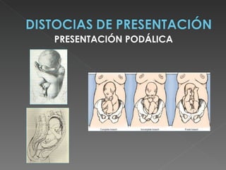 PRESENTACIÓN PODÁLICA
 