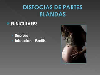    FUNICULARES

    › Ruptura
    › Infección - Funitis
 