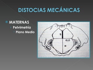    MATERNAS
    › Pelvimetría
       Plano Medio
 