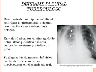 DERRAME PLEURAL
                  TUBERCULOSO

o   Resultante de una hipersensibilidad
    retardada a micobacterias o de una
    reactivación de una tuberculosis
    antigua.

o   En < de 35 años, con cuadro agudo de
    fiebre, dolor pleurítico, tos seca,
    sudoración nocturna y pérdida de
    peso.

o   Se diagnostica de manera definitiva
    con la identificación de las
    micobacterias en el espacio pleural.
 