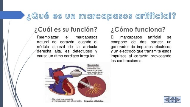 Marcapasos artificial