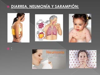  DIARREA, NEUMONÍA Y SARAMPIÓN:
 :
 